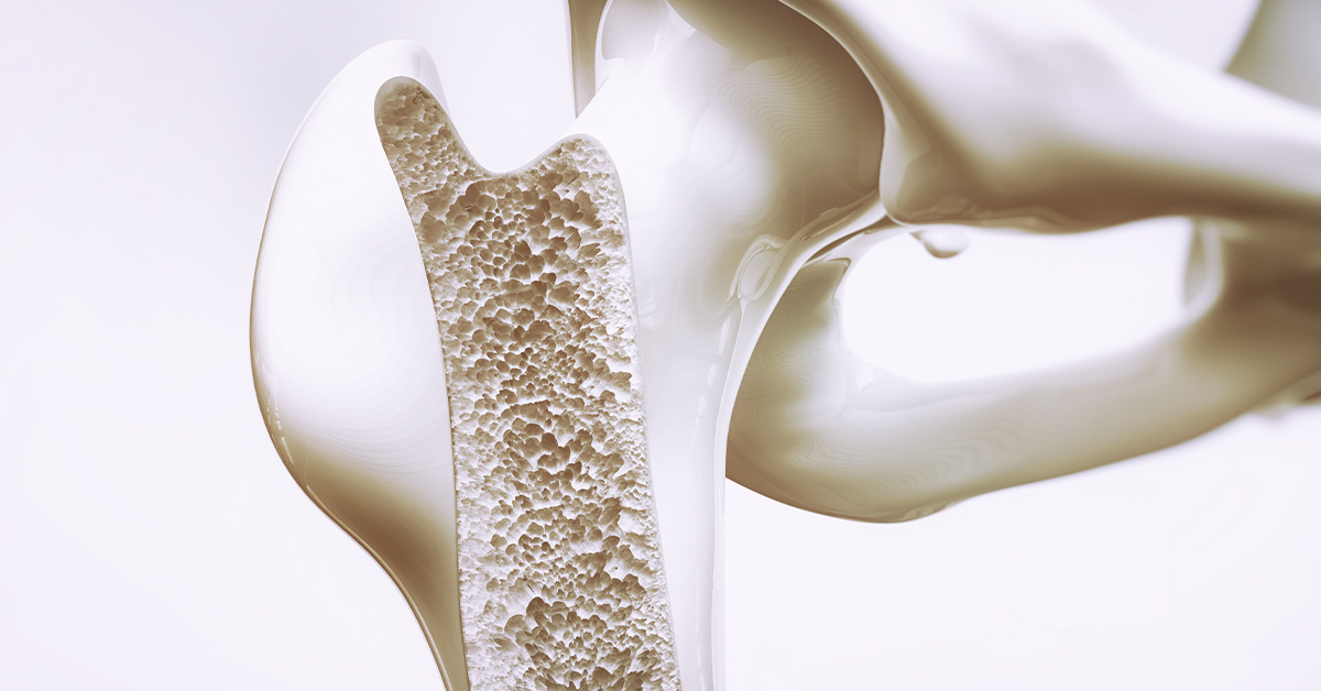 May is Osteoporosis Awareness Month: Learn How to Support Your Bone Health